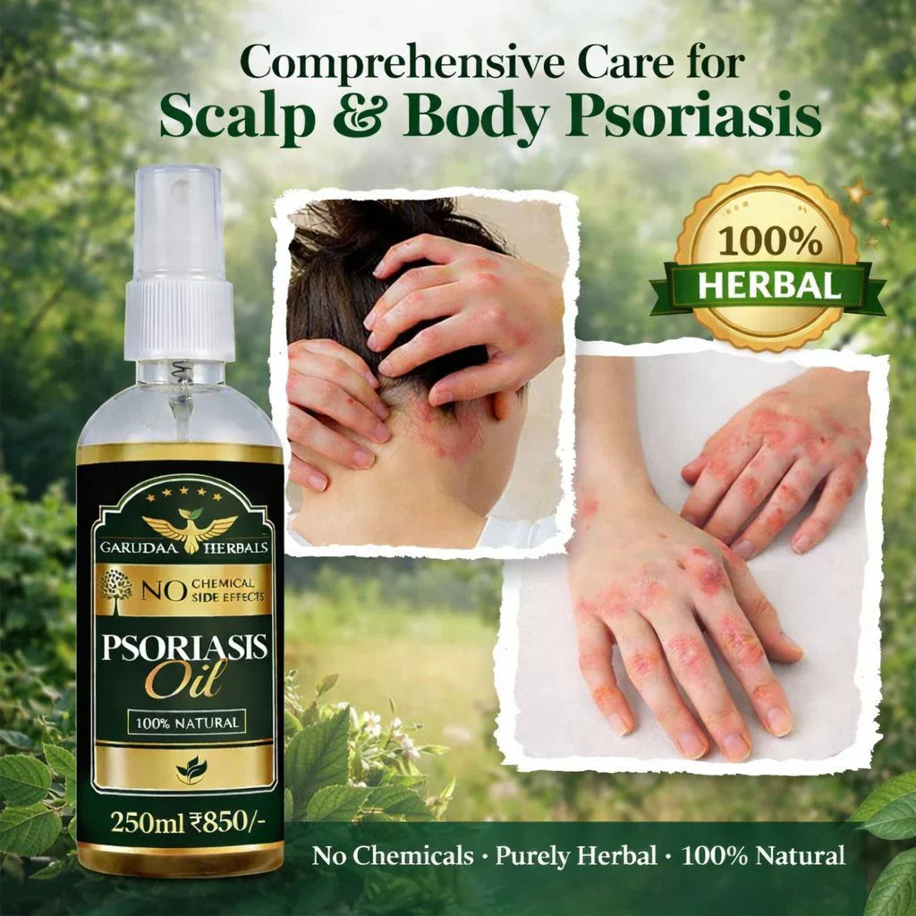 Psoriasis Oil-Advanced Psoriasis Clearing Oil