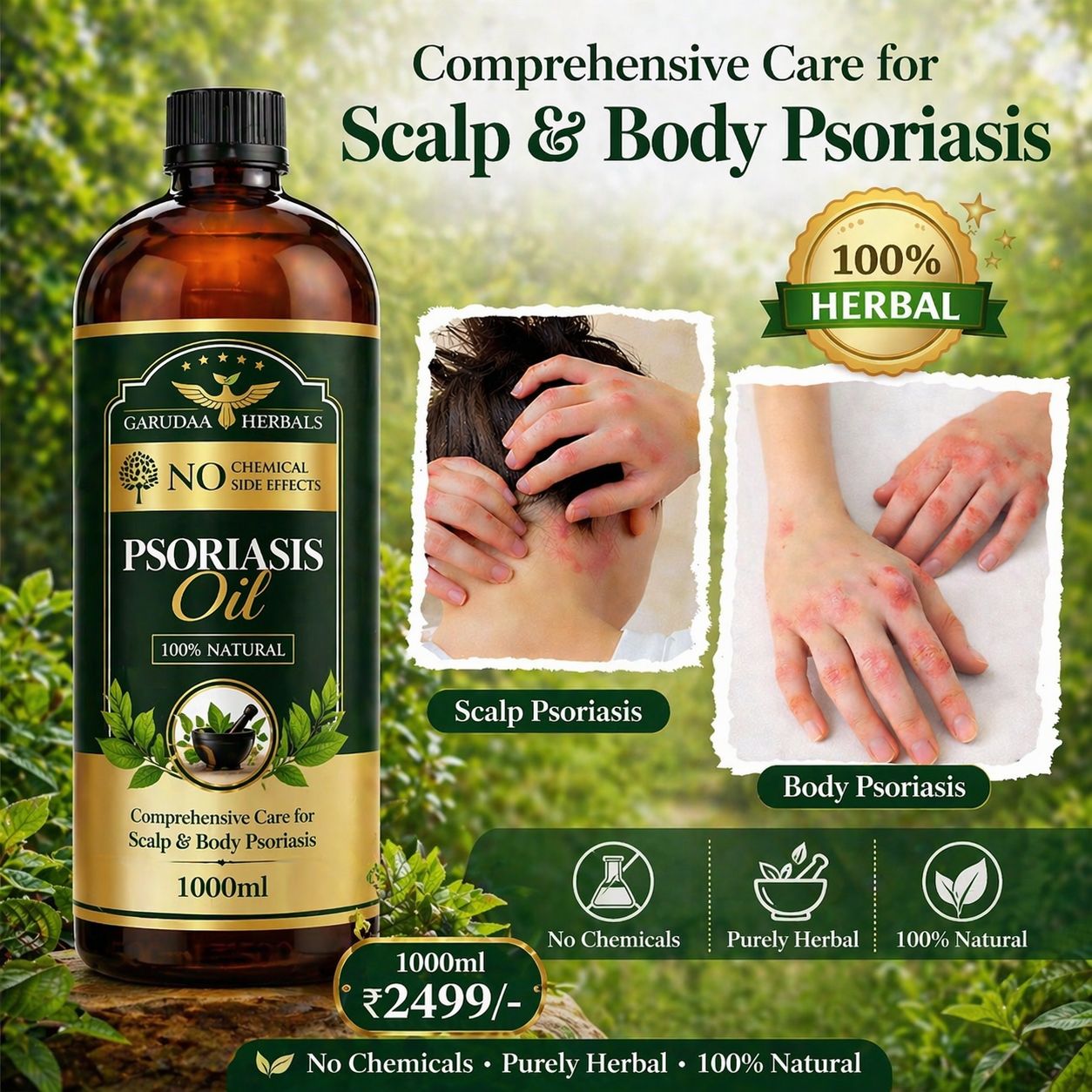 Garuda Herbal Psoriasis Oil-Advanced Psoriasis Clearing Oil