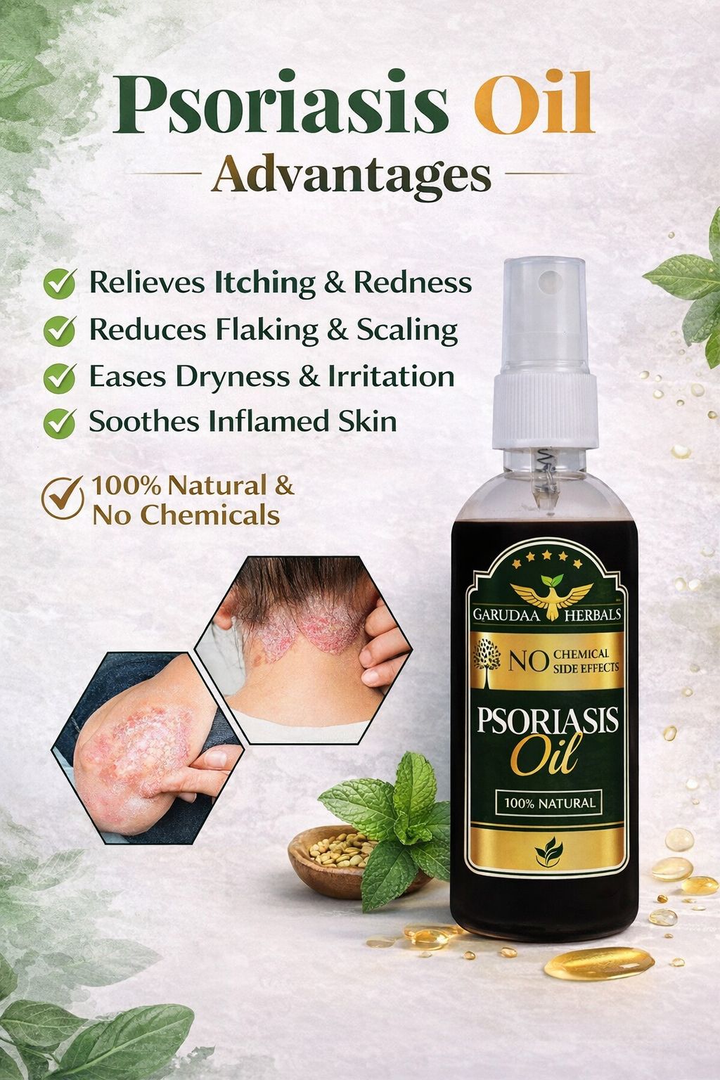 Garuda Herbal Psoriasis Oil-Advanced Psoriasis Clearing Oil
