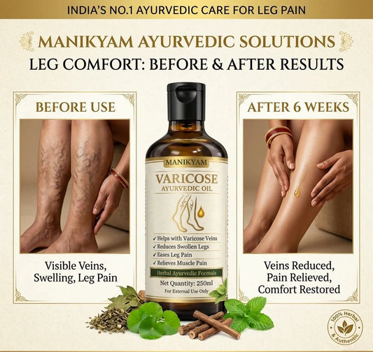 VARICOSE VEINS PAIN RELIEF OIL