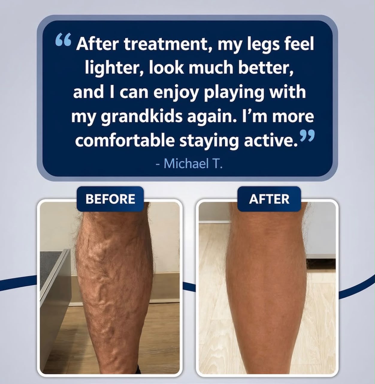 VARICOSE VEINS PAIN RELIEF OIL